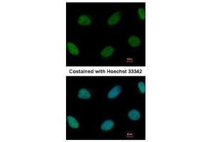 ICC/IF Image Immunofluorescence analysis of paraformaldehyde-fixed HeLa, using ZEB1, antibody at 1:1000 dilution. (ZEB1 抗体)