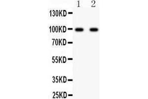 Anti- GRIA2 antibody, Western blotting All lanes: Anti GRIA2  at 0. (GRIA2 抗体  (AA 25-360))