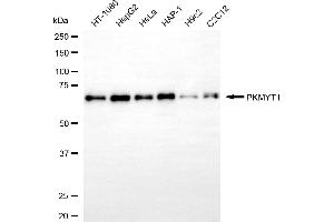 Western blotting analysis using PKMYT1 antibody (ABIN7800016).
