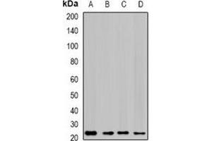 Western blot analysis of GTL3 expression in SKOV3 (A), HepG2 (B), mouse liver (C), rat lung (D) whole cell lysates. (C16orf80 抗体)