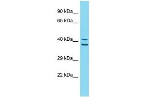 Host:  Rabbit  Target Name:  ZNF414  Sample Type:  Stomach Tumor lysates  Antibody Dilution:  1. (ZNF414 抗体  (C-Term))