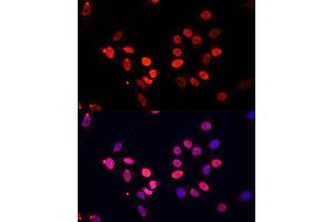 Immunofluorescence analysis of C6 cells using TriMethyl-Histone H3-K27 antibody (ABIN7267698) at dilution of 1:25.