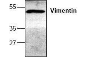 Image no. 1 for anti-Vimentin (VIM) antibody (ABIN127264) (Vimentin 抗体)
