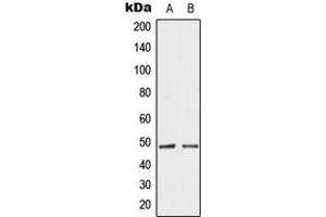 Western blot analysis of GATA4 expression in HepG2 (A), HeLa (B) whole cell lysates.