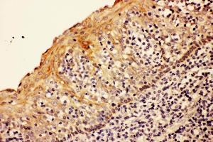 Anti- CASP8 antibody,IHC(P) IHC(P): Human Tonsil Tissue (Caspase 8 抗体  (N-Term))