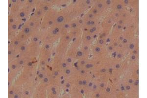Detection of BMP1 in Human Liver Tissue using Polyclonal Antibody to Bone Morphogenetic Protein 1 (BMP1) (BMP1 抗体  (AA 610-843))
