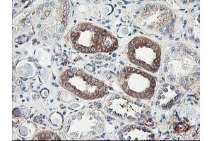 Immunohistochemical staining of paraffin-embedded Human Kidney tissue using anti-CDKN3 mouse monoclonal antibody. (CDKN3 抗体)