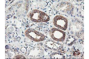 Immunohistochemical staining of paraffin-embedded Human Kidney tissue using anti-CDKN3 mouse monoclonal antibody. (CDKN3 抗体)