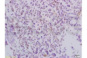 Formalin-fixed and paraffin embedded mouse lymphoma tissue labeled with Anti-TRAF3/CD40bp Polyclonal Antibody, Unconjugated (ABIN738921) at 1:200 followed by conjugation to the secondary antibody and DAB staining (TRAF3 抗体  (AA 101-200))