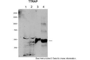 Sample: 1. (TDP2 抗体  (Middle Region))
