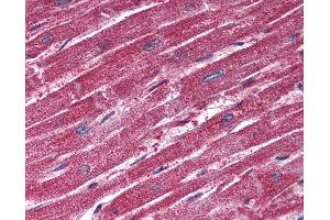 Anti-TRPM4 antibody IHC of human heart.