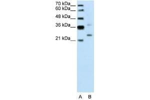 DCUN1D1 antibody used at 0. (DCUN1D1 抗体)