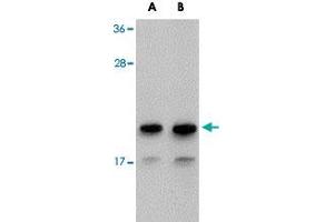 Western blot analysis of NDUFAF2 in Raji cell lysate with NDUFAF2 polyclonal antibody  at (A) 1 and (B) 2 ug/mL . (NDUFAF2 抗体  (C-Term))