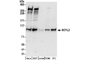anti-SCY1-Like 2 (SCYL2) (AA 825-875) antibody