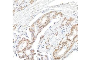 anti-Multiple Endocrine Neoplasia 1 (MEN1) (C-Term) antibody