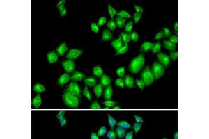 Immunofluorescence analysis of U2OS cells using DRD3 Polyclonal Antibody (DRD3 抗体)
