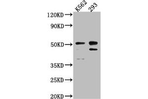 Western Blot Positive WB detected in: K562 whole cell lysate, 293 whole cell lysate All lanes: Caspase-2 antibody at 1:1000 Secondary Goat polyclonal to rabbit IgG at 1/50000 dilution Predicted band size: 51, 35, 11 kDa Observed band size: 51 kDa (Recombinant Caspase 2 抗体)