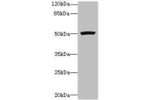 Western blot All lanes: PORCN antibody at 3 μg/mL + Mouse thymus tissue Secondary Goat polyclonal to rabbit IgG at 1/10000 dilution Predicted band size: 53, 52, 43 kDa Observed band size: 53 kDa (PORCN 抗体  (AA 269-332))