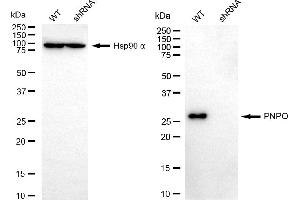 Western blotting analysis using PNPO antibody (ABIN7800075).