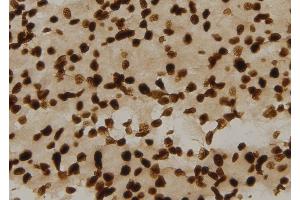 Immunohistochemistry (IHC) image for anti-Ferritin, Heavy Polypeptide 1 (FTH1) (C-Term) antibody (ABIN6261825)