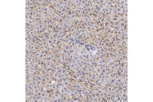 IHC analysis of Tim 2/Timd2 using anti-Tim 2/Timd2 antibody (ABIN7602933).