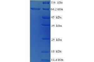 SDS-PAGE (SDS) image for Keratin 14 (KRT14) (AA 1-472), (full length) protein (His-SUMO Tag) (ABIN5709825)