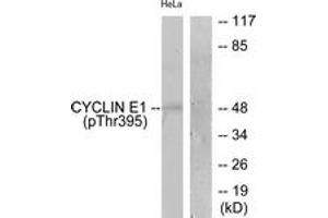 Western blot analysis of extracts from HeLa cells treated with Paclitaxel 1uM 60', using Cyclin E1 (Phospho-Thr395) Antibody. (Cyclin E1 抗体  (pThr395))