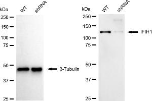 Western blotting analysis using IFIH1 antibody (ABIN7799084). (Recombinant IFIH1 抗体)