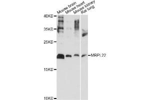Western blot analysis of extracts of various cell lines, using MRPL22 antibody (ABIN6292563) at 1:1000 dilution. (MRPL22 抗体)