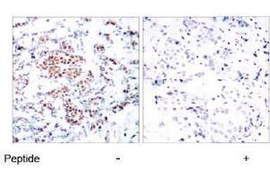 Image no. 1 for anti-Signal Transducer and Activator of Transcription 5A (STAT5A) (Tyr694) antibody (ABIN197180)