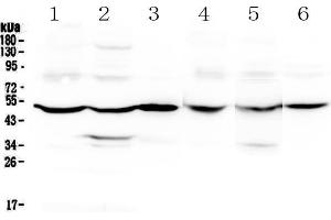 Western blot analysis of GDA using anti-GDA antibody . (GDA 抗体  (AA 220-446))