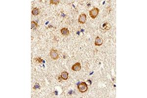 Immunohistochemical analysis of paraffin-embedded M. (Myosin 抗体  (AA 654-668))