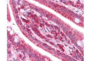 TST antibody was used for immunohistochemistry at a concentration of 4-8 ug/ml. (TST 抗体)