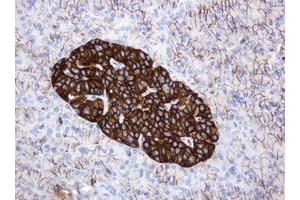 Image no. 1 for anti-CD99 (CD99) antibody (ABIN1497382) (CD99 抗体)
