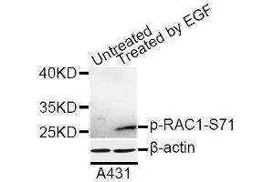 Western blot analysis of extracts of A-431 cells, using Phospho-RAC1-S71 antibody (ABIN5969930) at 1/1000 dilution. (RAC1 抗体  (pSer71))