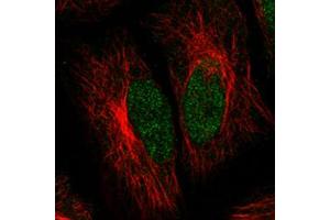 Immunofluorescent staining of HeLa cells with ATRX monoclonal antibody, clone CL0537  (Green) shows clear nuclear (without nucleoli) staining. (ATRX 抗体)