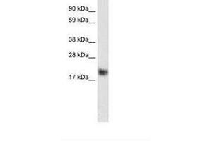 Image no. 1 for anti-Cysteine and Glycine-Rich Protein 3 (CSRP3) (C-Term) antibody (ABIN6735943) (CSRP3 抗体  (C-Term))