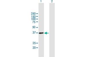 Western Blot analysis of UPRT expression in transfected 293T cell line by UPRT MaxPab polyclonal antibody. (UPRT 抗体  (AA 1-309))