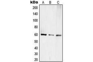 Western blot analysis of TCEB3C expression in Jurkat (A), mouse kidney (B), rat kidney (C) whole cell lysates. (TCEB3C 抗体  (C-Term))