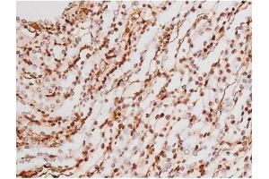 Immunohistochemistry (IHC) image for anti-Mast/stem Cell Growth Factor Receptor (KIT) (pTyr721) antibody (ABIN6256004)
