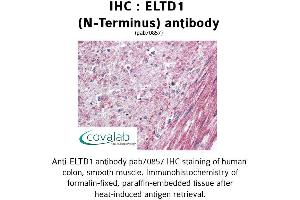Image no. 1 for anti-EGF, Latrophilin and Seven Transmembrane Domain Containing 1 (ELTD1) (Extracellular Domain), (N-Term) antibody (ABIN1733980)