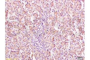 Immunohistochemistry (IHC) image for anti-Growth Hormone Receptor (GHR) (AA 101-200) antibody (ABIN671481)