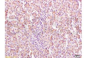 Formalin-fixed and paraffin embedded rat liver tissue labeled Anti-GHR Polyclonal Antibody, Unconjugated (ABIN671481) at 1:400, followed by conjugation to the secondary antibody and DAB staining (Growth Hormone Receptor 抗体  (AA 101-200))