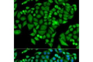 Immunofluorescence analysis of MCF-7 cells using CHAF1B Polyclonal Antibody (CHAF1B 抗体)