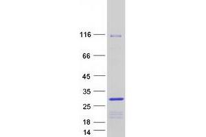 Western Blotting (WB) image for Chromobox Homolog 5 (CBX5) (Transcript Variant 2) protein (Myc-DYKDDDDK Tag) (ABIN2713266)