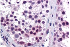 Human Testis: Formalin-Fixed, Paraffin-Embedded (FFPE) (HOXA5 抗体  (AA 143-192))