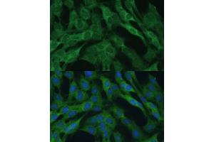 Immunofluorescence analysis of C6 cells using IDH1 Polyclonal Antibody (ABIN6131797, ABIN6142143, ABIN6142144 and ABIN6217174) at dilution of 1:100 (40x lens). (IDH1 抗体  (AA 1-414))