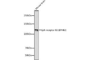 Western blot analysis of extracts of Mouse brain, using Eph receptor B3 (EPHB3) (EPHB3) antibody (ABIN7266972) at 1:1000 dilution. (EPH Receptor B3 抗体)