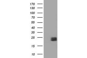 Western Blotting (WB) image for anti-Ephrin A2 (EFNA2) antibody (ABIN1497957)