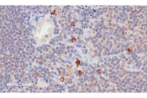Immunohistochemical staining of human tonsil tissue using anti-CD3E antibody. (Recombinant CD3 epsilon 抗体)